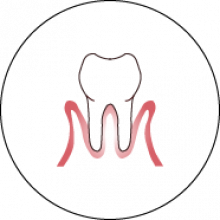 Periodoncia